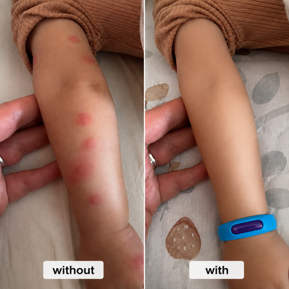 Mosquito Bracelet🥇