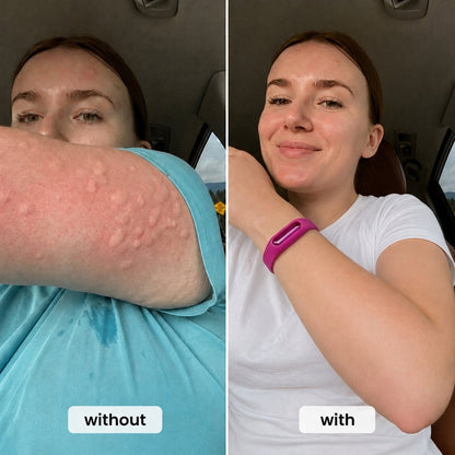Mosquito Bracelet🥇